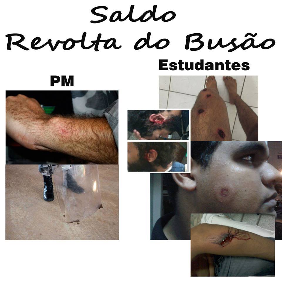 Compare ferimentos sofridos por um policial e por membros da #RevoltaDoBusão